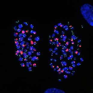 chromosomes in human lung cells