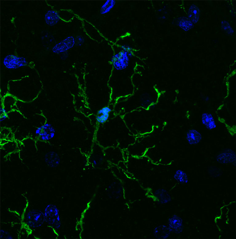 Corpped-P35-microglia-2-grid