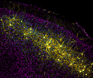 nerve cells in the mouse brain