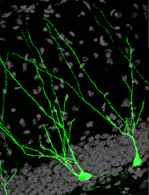 Neurogenesis Human brains