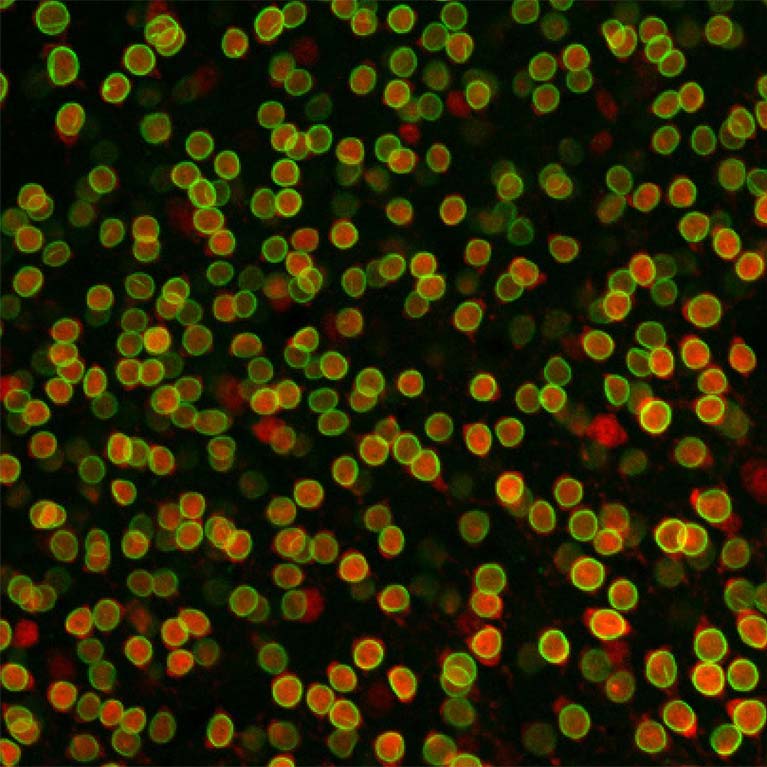 Helmsley Center For Genomic Medicine Salk Institute For Biological