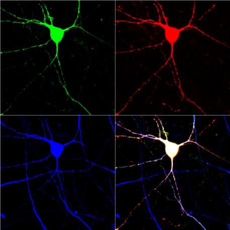 Los científicos han creado neuronas de señalización de serotonina a partir de células de la piel humana