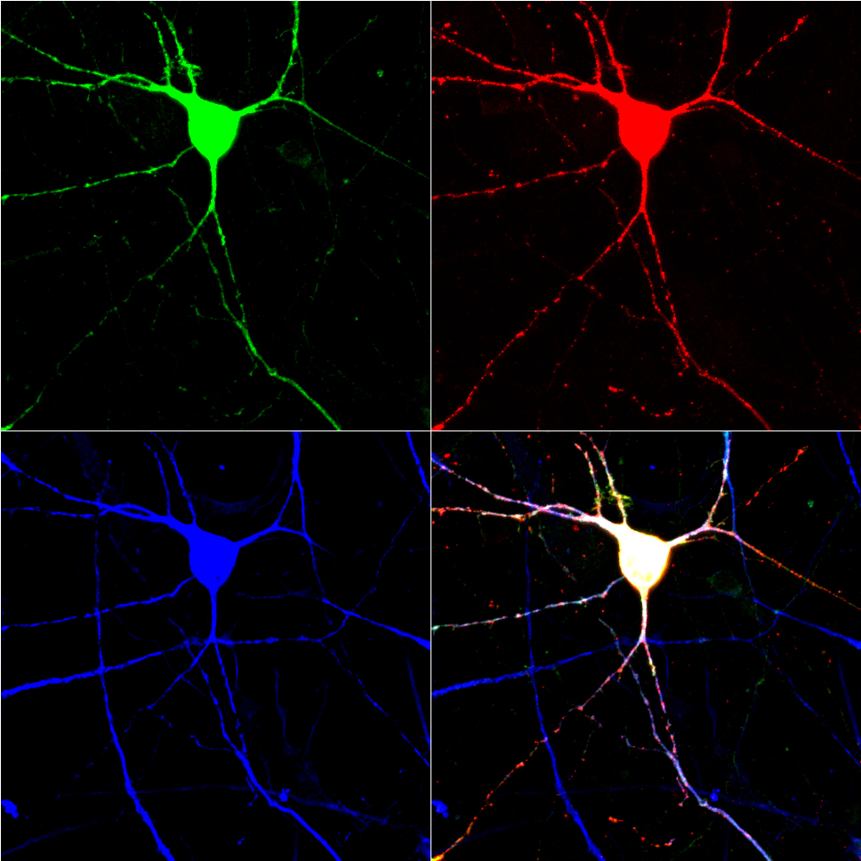 Serotonergic neurons of the. Revolution neuron. Neuron Штурмовик. Активация нейронов Мем.