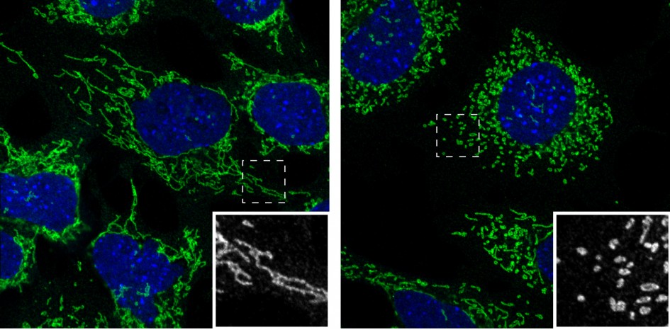 mitochondriaal netwerk