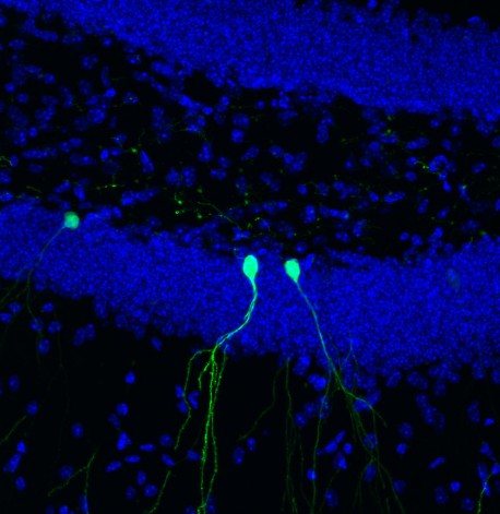 Newborn neurons RV-GFP 40x 2013