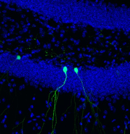 Neuronas recién nacidas RV-GFP 40x 2013