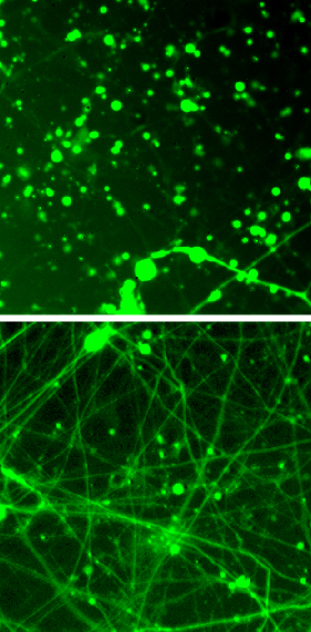 rapamycin-effect-on-MILS-neurons