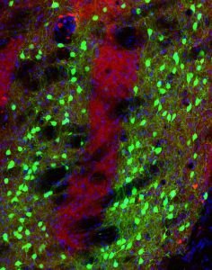 Parche-Matrix-Confocal_no-text