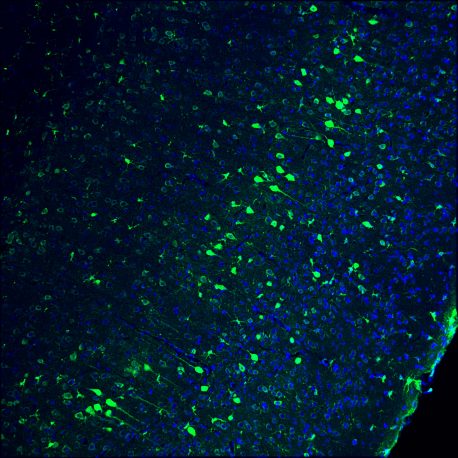 gfp-mche-dapi-11stks-10um_016-hr