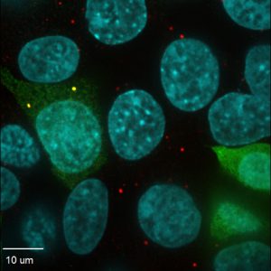 nobody-overlay-nuclei-1