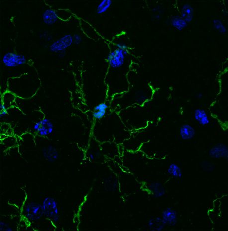 Salk and UC San Diego scientists conducted a vast survey of microglia (pictured here), revealing links to neurodegenerative diseases and psychiatric illnesses.
