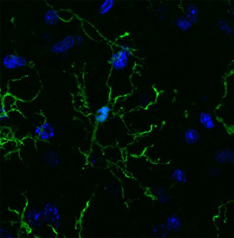 Los científicos de Salk y UC San Diego realizaron una amplia encuesta de microglía (en la foto aquí), revelando vínculos con enfermedades neurodegenerativas y enfermedades psiquiátricas.