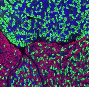 Partial view of a mouse calf muscle stained for different types of muscle fibers: oxidative slow-twitch (blue), oxidative fast-twitch (green), glycolytic fast-twitch (red).