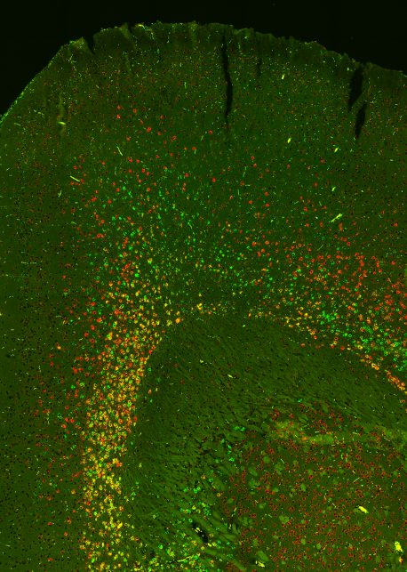 Salk and UC San Diego scientists identified neuron types predicted by epigenomic signatures. The image shows neuron populations expressing marker genes for specific neuron subtypes: Tle4 (red), Sulf1 (green) or both (yellow).