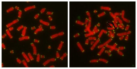 Chromosomes (red) with telomeres (green) that are undisturbed remain pristine and separate. Right: when CYREN is absent, chromosomes that have been disturbed to artificially trigger NHEJ show fusions that are characteristic of repair after DNA is copied.