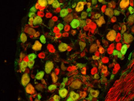 La presencia de p75 (verde) y Ret (rojo) juntas en algunas neuronas sensoriales sugiere que las proteínas pueden interactuar entre sí.