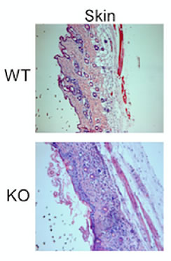 Skin samples from mice whose regulatory immune cells (Tregs) lack the Lkb1 protein (bottom) are under attack from other immune cells (purple dots) compared to normal mice whose Tregs have the Lkb1 protein (top).