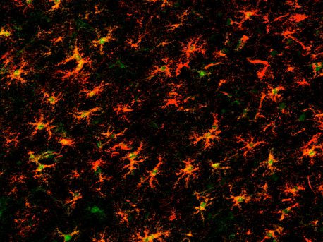 Ribosomes in astrocytes are labeled red using the ribo-tag method. Green stain indicates the nucleus of the star-shaped support cells.