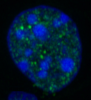 Image shows NONO protein immunostained green in liver cells after a meal. Blue indicates cell nuclei.