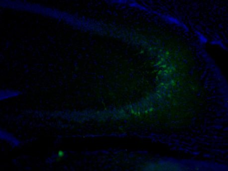 Pictured are cells in the mouse hippocampus (whose nuclei are stained blue) that underwent mobilization of the L1 gene (green). 
