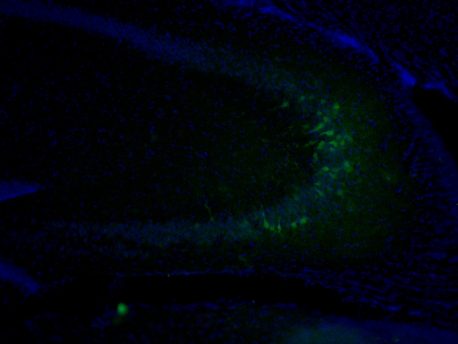 En la imagen se muestran células en el hipocampo de ratón (cuyos núcleos están teñidos de azul) que se sometieron a la movilización del gen L1 (verde).