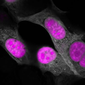 CasRx (magenta) targeting RNA in the nucleus of human cells (gray).
