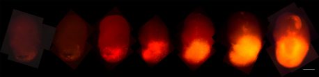 From left to right, tumor cells labeled with red fluorescent marker tdTomato spread in a cerebral organoid over a time period of 2, 3, 4, 6, 8, 10 and 13 weeks after transduction.