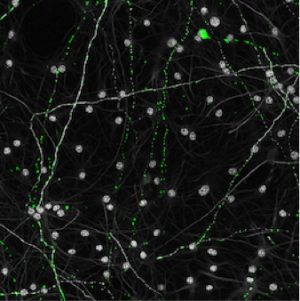 Aged mitochondria (green) in old neurons (gray) appear mostly as small punctate dots rather than a large interconnected network.