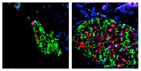 Enhanced activation of vitamin D curbs type 2 diabetes progression in animal models.