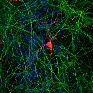 Los investigadores de Salk utilizaron células madre para derivar neuronas piramidales CA3 (verde), incluido un subtipo raro de las células (rojo).