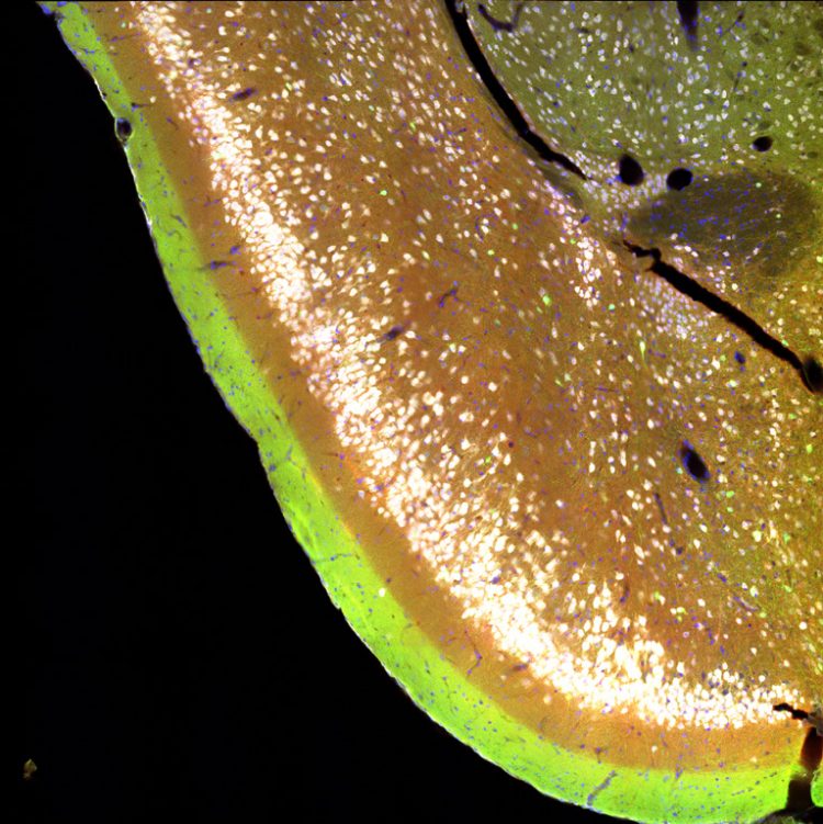 Staining one section of the brain, as shown, reveals layers of the piriform cortex—in green, brownish-red, and white—and other cells of the brain in blue.