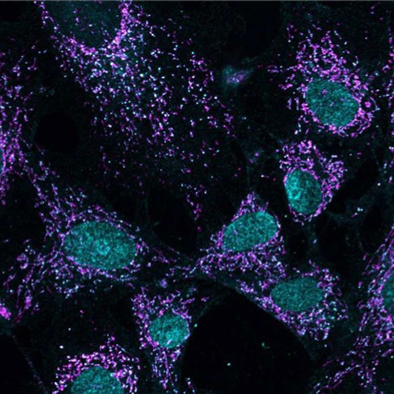 shadel-mitochondria-grid