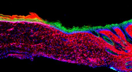 La imagen representa la primera prueba de principio para la regeneración exitosa de un órgano funcional (la piel) dentro de un mamífero, mediante una técnica conocida como reprogramación in vivo basada en AAV. Los tejidos epiteliales (piel) se generaron convirtiendo un tipo de célula (rojo: células mesenquimales) en otro (verde: queratinocitos basales) dentro de una úlcera grande en un modelo de ratón de laboratorio.