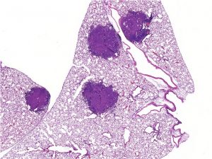 Genetically engineered lung tumors (solid purple) within the native lung environment are shown.