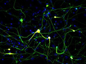 Induced neuronal cells