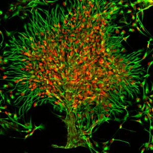 A stylized microscopy image of forebrain neural progenitor cells from chimpanzees described in the publication. The image represents the work's potential for offering insights into the evolution of the primate tree of life.