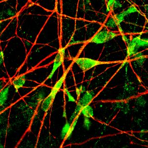 Human serotonergic neuron projections (red) and cell bodies (green).