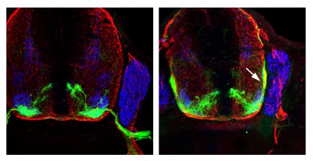 Left: Motor neurons (green) exit the spinal cord (red) and enter the periphery of the body to connect with muscles. Right: Motor neurons (white arrow) without the guidance of p190 are trapped within the spinal cord. 