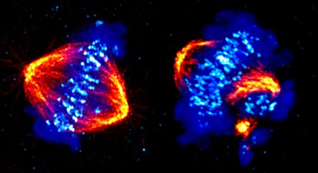 Left: The process of cell division, called mitosis, showing structures called microtubules (orange) pulling the chromosomes (blue) to opposite sides, called spindle poles, of the cell. CDK12 is critical for proper chromosome alignment and progression through mitosis. Right: Without CDK12 the chromosomes become misaligned and detach from the spindle poles.