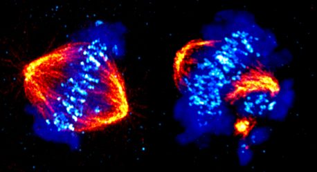 Izquierda: el proceso de división celular, llamado mitosis, que muestra estructuras llamadas microtúbulos (naranja) que tiran de los cromosomas (azul) hacia lados opuestos, llamados polos del huso, de la célula. CDK12 es fundamental para la correcta alineación cromosómica y la progresión a través de la mitosis. Derecha: Sin CDK12, los cromosomas se desalinean y se separan de los polos del huso.