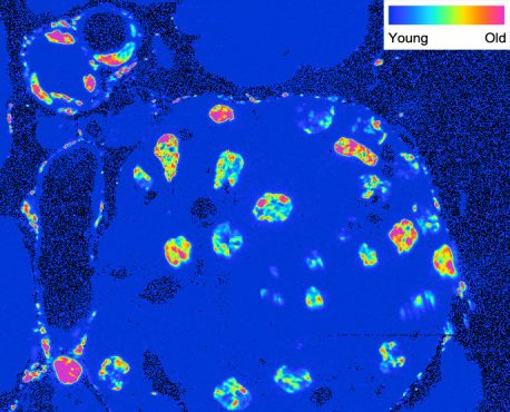 Imágenes de isótopos de diferentes células dentro de un islote de Langerhans dentro del páncreas. Las células más viejas tienen un esquema de color de amarillo a rosa, mientras que las células más jóvenes exhiben un patrón de color de azul a verde.