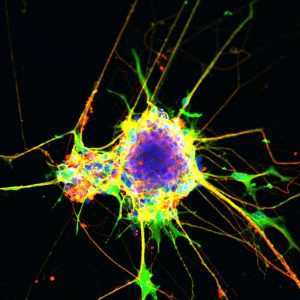 Neurons generated using the cell culture method described in the paper. 