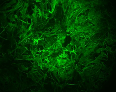Astrocytes tagged with green fluorescent antibody