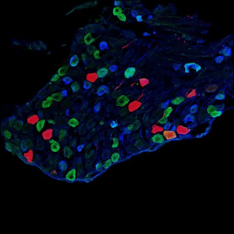 Una sección transversal de un ganglio de la raíz dorsal que muestra las neuronas sensoriales que transmiten información táctil ligera desde la piel a las neuronas Y1 dentro de la médula espinal.