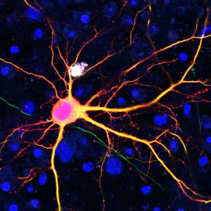 Neuron targeted using the SATI technology.