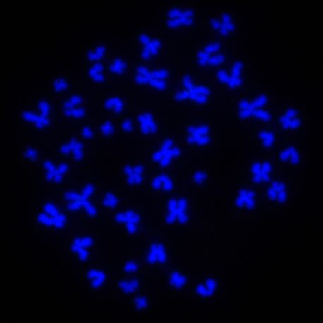 Human chromosomes imaged by the Dixon lab during the metaphase stage of cell division.