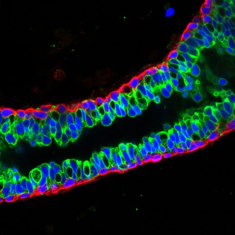 Luminal cells (green) and basal cells (red) in mature mouse breast tissue.
