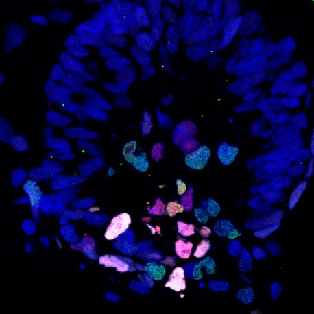 Pictured is Day 17 of a cultured primate embryo; the various colors indicate markers of cellular differentiation (specialization).