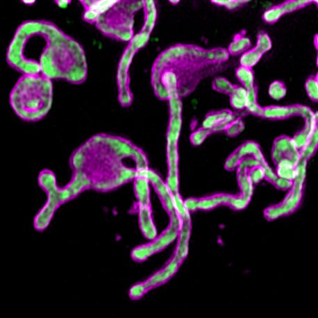 La microproteína PIGBOS (magenta) se muestra sentada en las membranas externas de las mitocondrias (verde), donde está lista para hacer contacto con otros orgánulos en la célula.