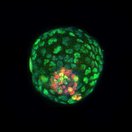 En la imagen se muestran estructuras similares a blastocistos (blastoides) de células cultivadas teñidas con inmunofluorescencia para el marcador de trofoectodermo CDX2 (verde) y el marcador de masa celular interna SOX2 (rojo). El trofoectodermo forma las células externas del blastoide.